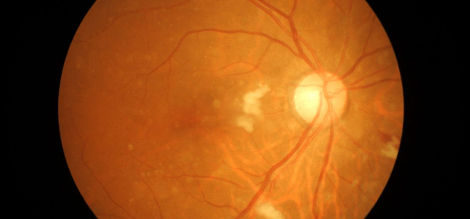 DMLA-dr-sophia-bennis